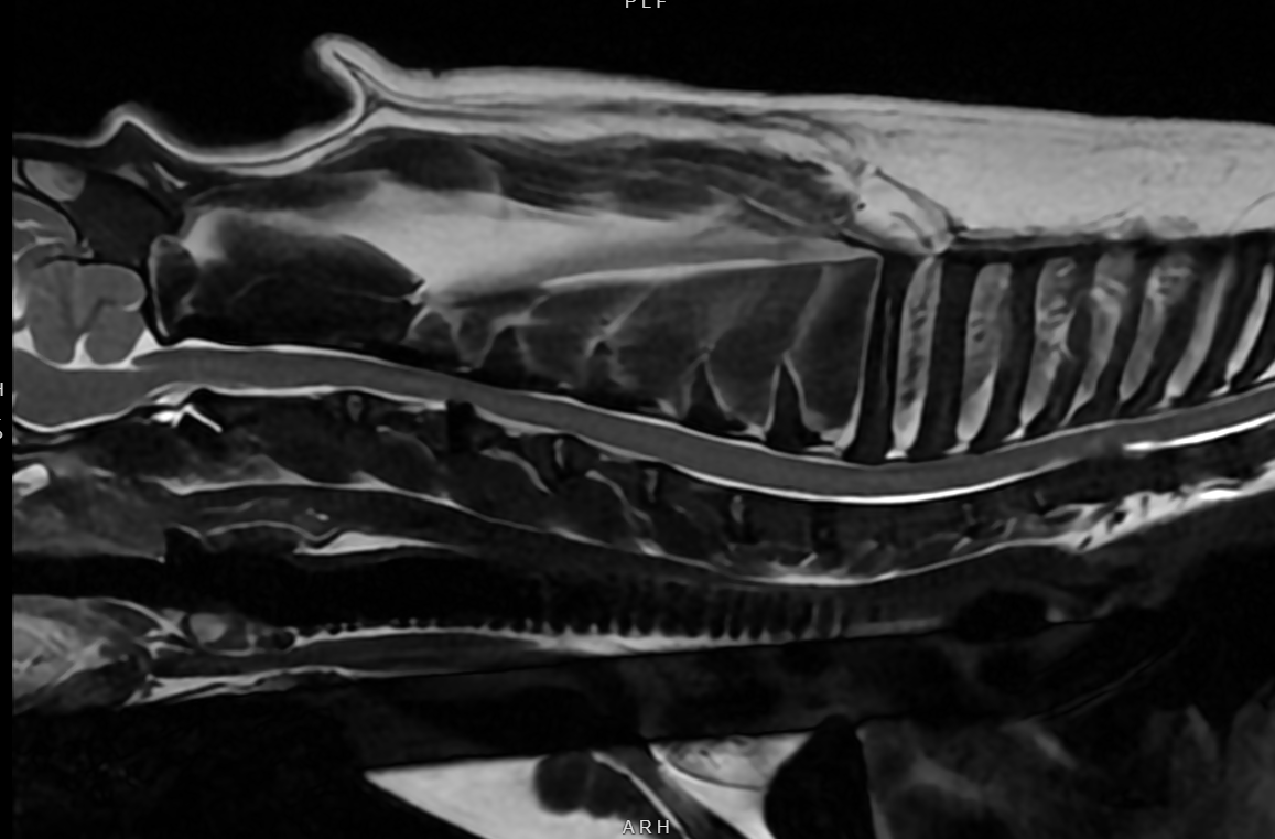 mri image odette
